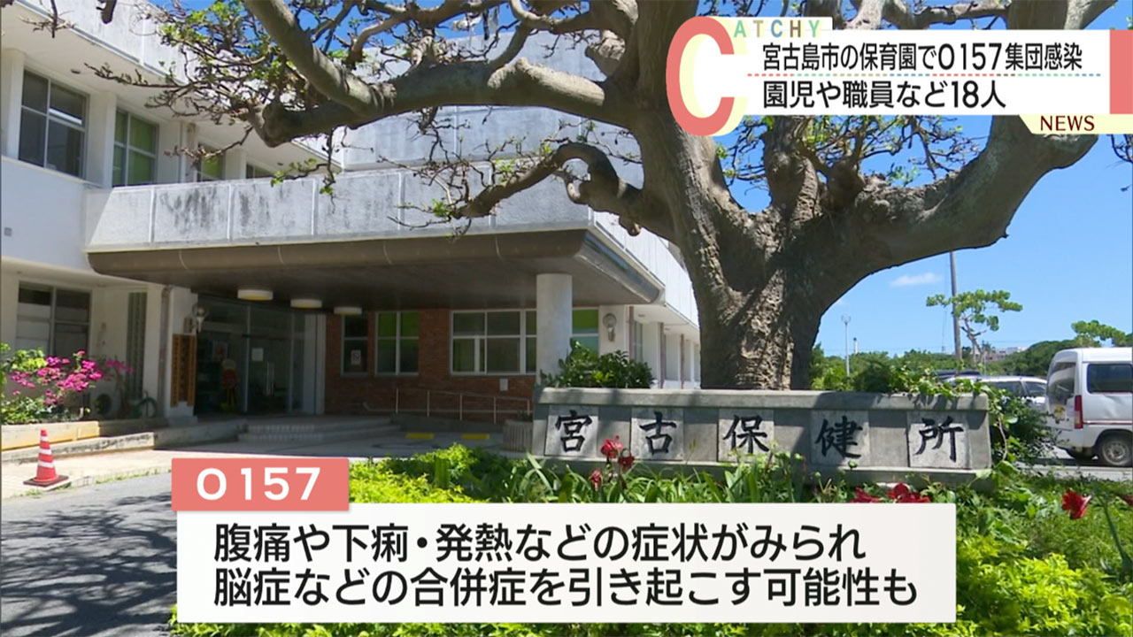 宮古島市の保育園でＯ１５７の集団感染